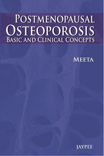 Post-Menopausal Osteoporosis