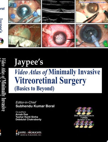 Jaypee’s Video Atlas of Minimally Invasive Vitreoretinal Surgery (Basics to Beyond)