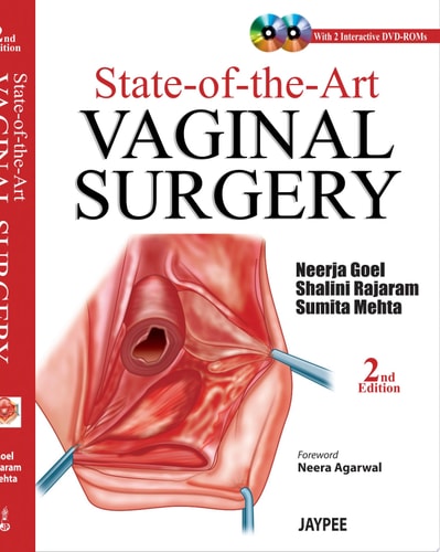 State-of-the-Art Vaginal Surgery-zoom-