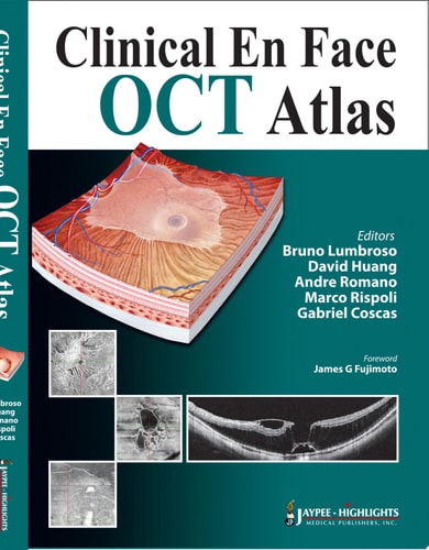 Clinical En Face OCT Atlas-zoom-