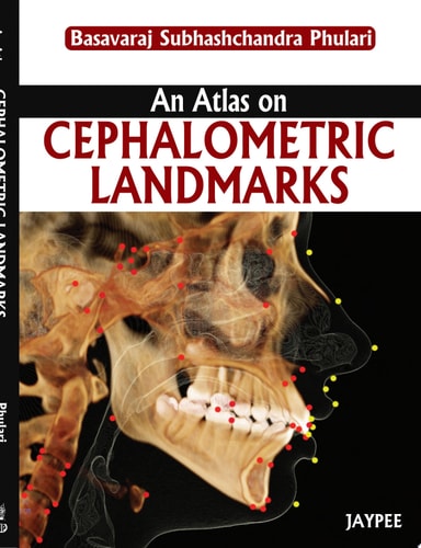 An Atlas on Cephalometric Landmarks