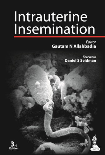 Intrauterine Insemination
