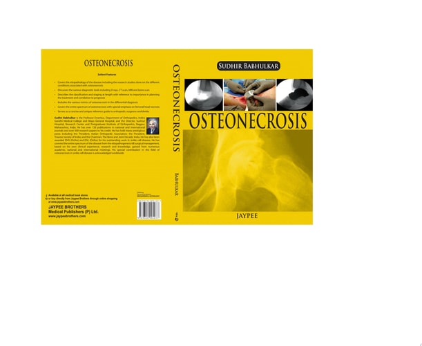 Osteonecrosis