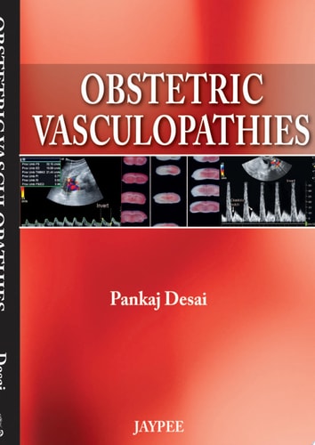 Obstetric Vasculopathies