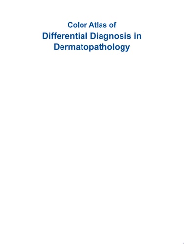 Color Atlas of Differential Diagnosis in Dermatopathology-zoom-1