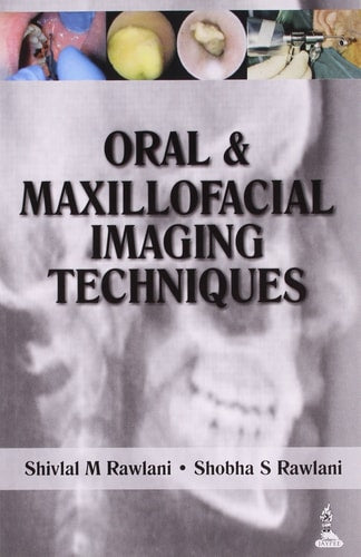 Oral and Maxillofacial Imaging Techniques