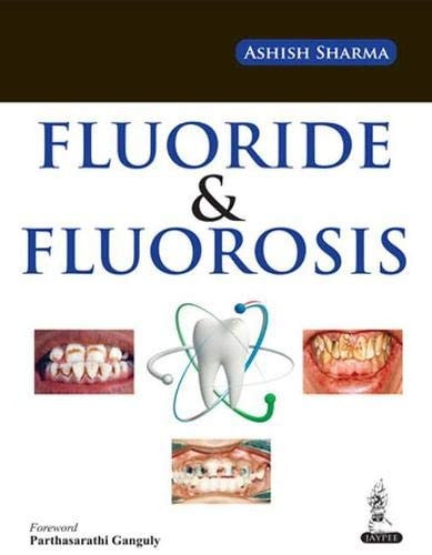 Fluoride and Fluorosis