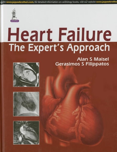 Heart Failure The Expert's Approach