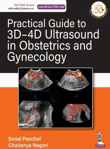 Practical Guide to 3D-4D Ultrasound in Obstetrics and Gynecology