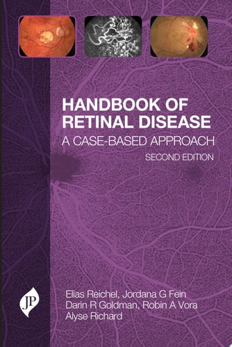 Handbook of Retinal Disease A Case-Based Approach-zoom-1