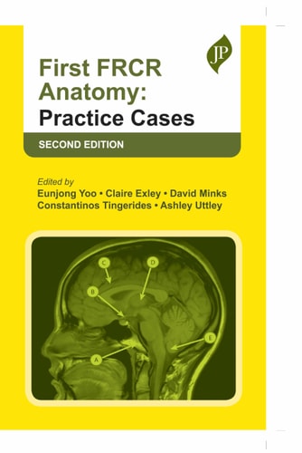 First FRCR Anatomy: Practice Cases