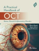 Practical Handbook of OCT Retina, Choroid & Inflammatory Disorders