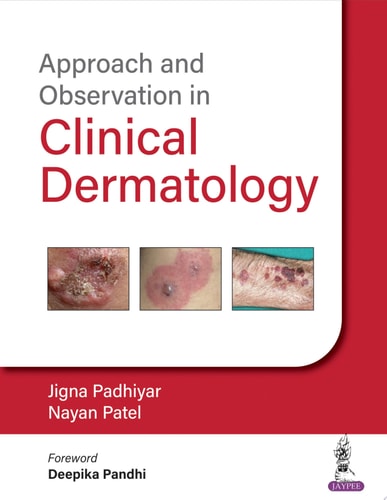Approach and Observation in Clinical Dermatology-zoom-