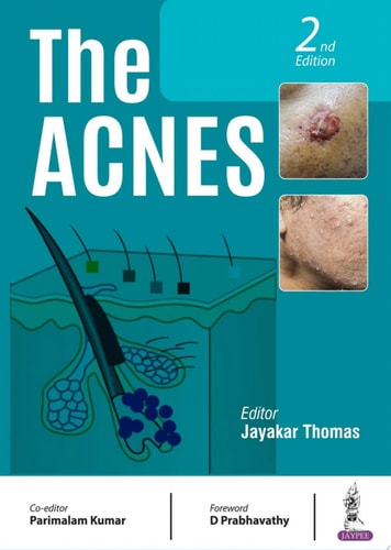 The Acnes-1
