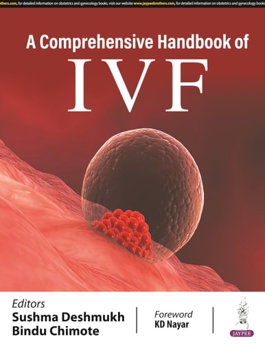 A Comprehensive Handbook of IVF-zoom-1