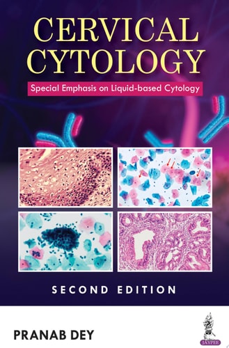 Cervical Cytology Special Emphasis on Liquid-based Cytology