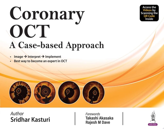 Coronary OCT A Case-based Approach