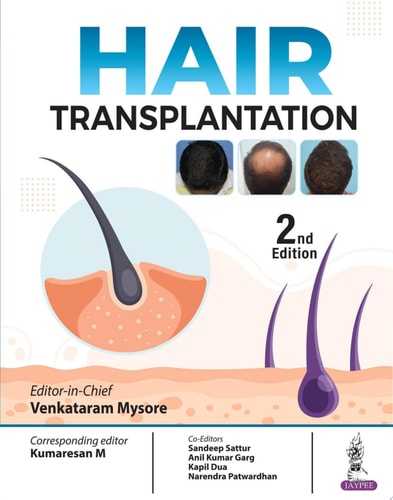 Hair Transplantation-1
