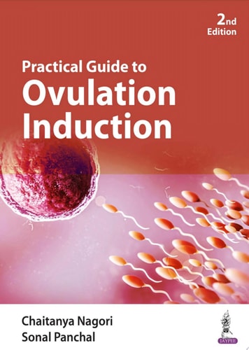 Practical Guide to Ovulation Induction-zoom-1