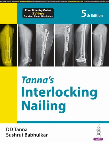 Tanna’s Interlocking Nailing-zoom-1