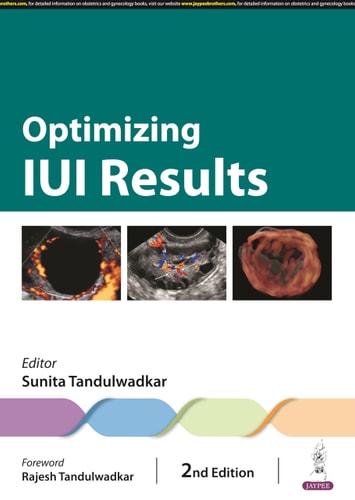 Optimizing IUI Results-1