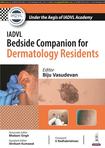 IADVL Bedside Companion for Dermatology Residents-zoom-