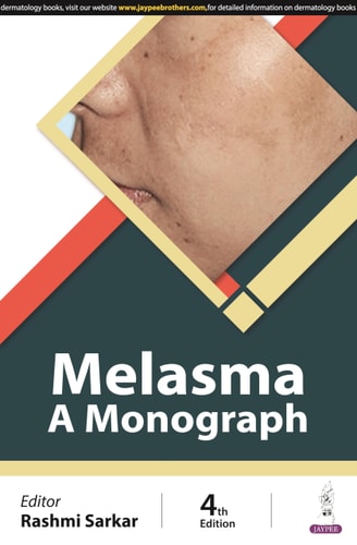 Melasma A Monograph-zoom-1