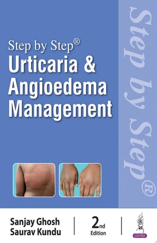 Step by Step: Urticaria & Angioedema Management