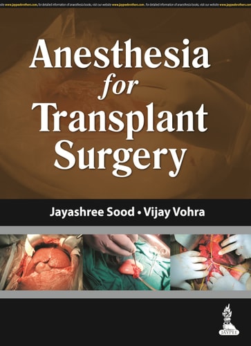 Anesthesia for Transplant Surgery-zoom-1