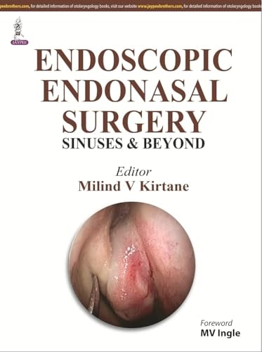 Endoscopic Endonasal Surgery Sinuses and Beyond