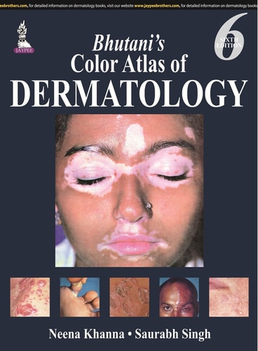 Bhutani’s Color Atlas of Dermatology