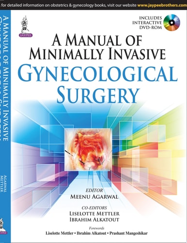 A Manual of Minimally Invasive Gynecological Surgery-zoom-