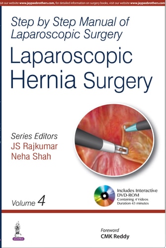 Step by Step Manual of Laparoscopic Surgery Laparoscopic Hernia Surgery-zoom-