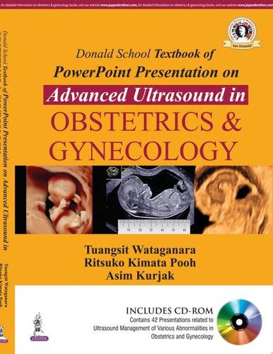 Donald School Textbook of Powerpoint Presentation on Advanced Ultrasound in Obstetrics & Gynecology-zoom-