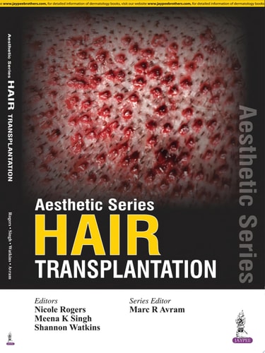 Aesthetic Series - Hair Transplantation