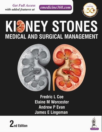 Kidney Stones Medical and Surgical Management
