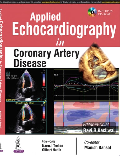 Applied Echocardiography in Coronary Artery Disease