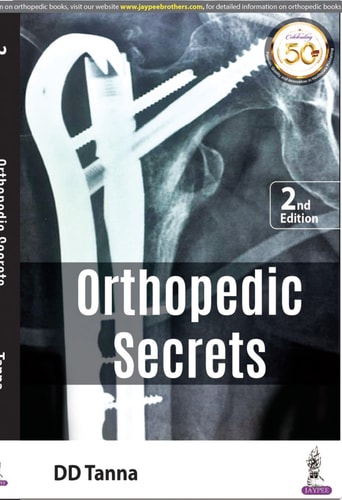 Orthopaedic Secrets