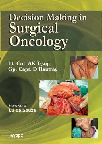 Decision Making in Surgical Oncology-1