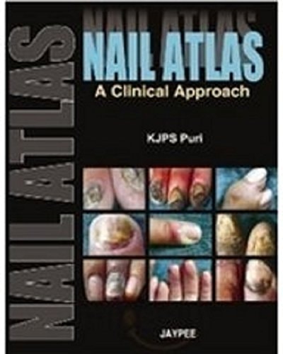Nail Atlas