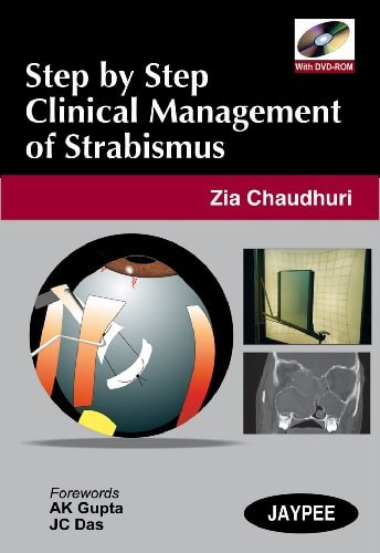 Clinical Management of Strabismus