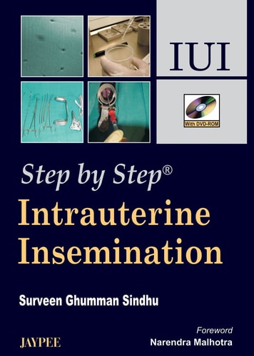 Intrauterine Insemination