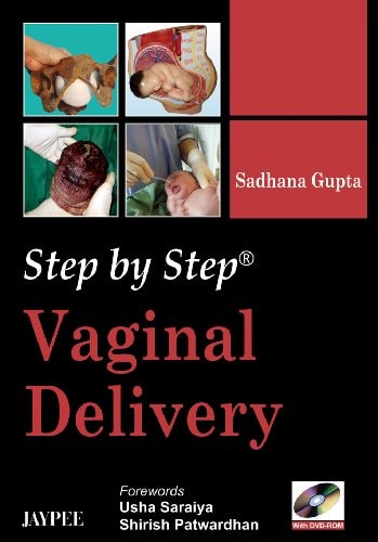 Step by Step: Vaginal Delivery