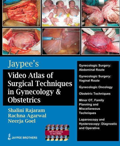 Jaypee's Video Atlas of Surgical Techniques in Gyn. & Obst. (DVD)