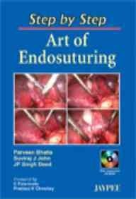 Step by Step Art of Endosuturing