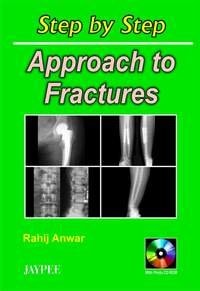 Step by Step Approach To Fractures