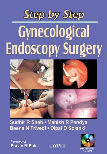 Step by Step: Gynecological Endoscopy Surgery