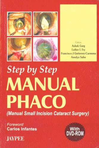 Step by Step Manual Phaco with Dvd-rom by Garg