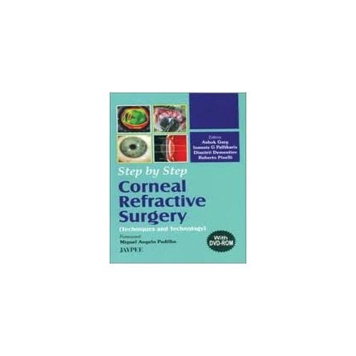 Step by Step: Corneal Refractive Surgery