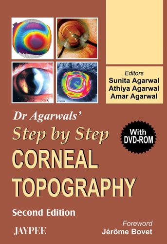 Dr. Agarwal's Step by Step Corneal Topography with DVD-ROM, 2/e